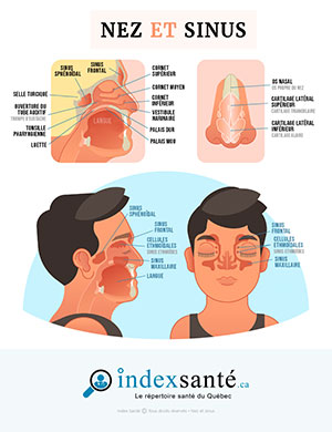 Sinusite : principaux symptômes (infographie) - Index Santé