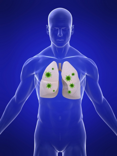 Mois de sensibilisation au cancer du poumon - L'Institut et sa fondation dévoilent l'indice poumons