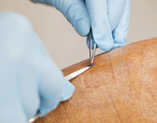 L'action collective est nécessaire pour arrêter une maladie dangereuse